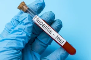 Brasil ultrapassa mil mortes e contabiliza mais de 34 mil casos de hepatite viral em 2025