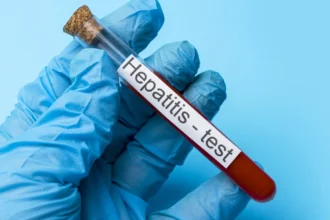 Casos de hepatite viral no Brasil em 2025 com mais de mil mortes e 34 mil infecções registradas.