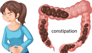 Prisão de ventre: entenda sintomas, causas e opções de tratamento