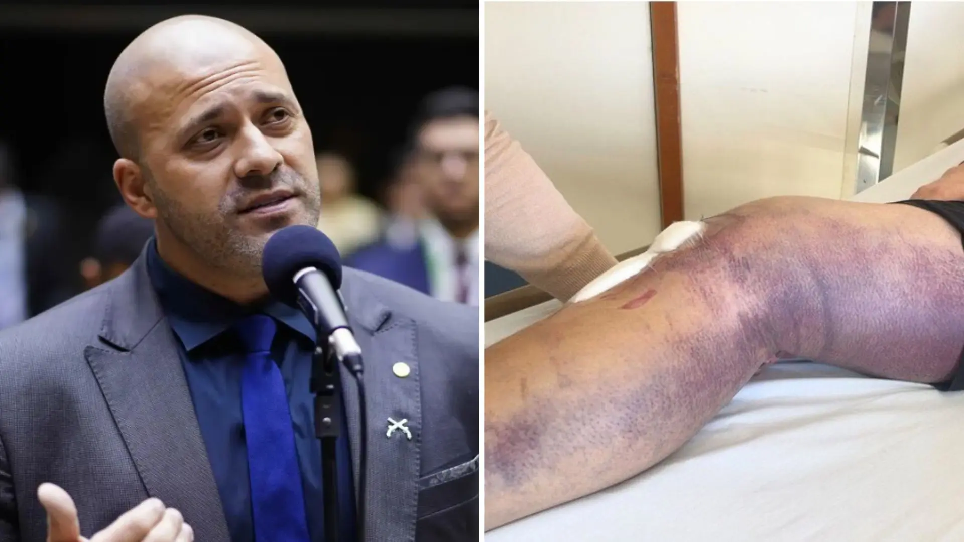 PGR apoia tratamento pós-operatório de Daniel Silveira em clínica particular - Imagem do artigo original