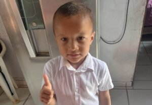 Menino de 5 anos é internado com 10% do corpo queimado após explosão de churrasqueira em Palmas