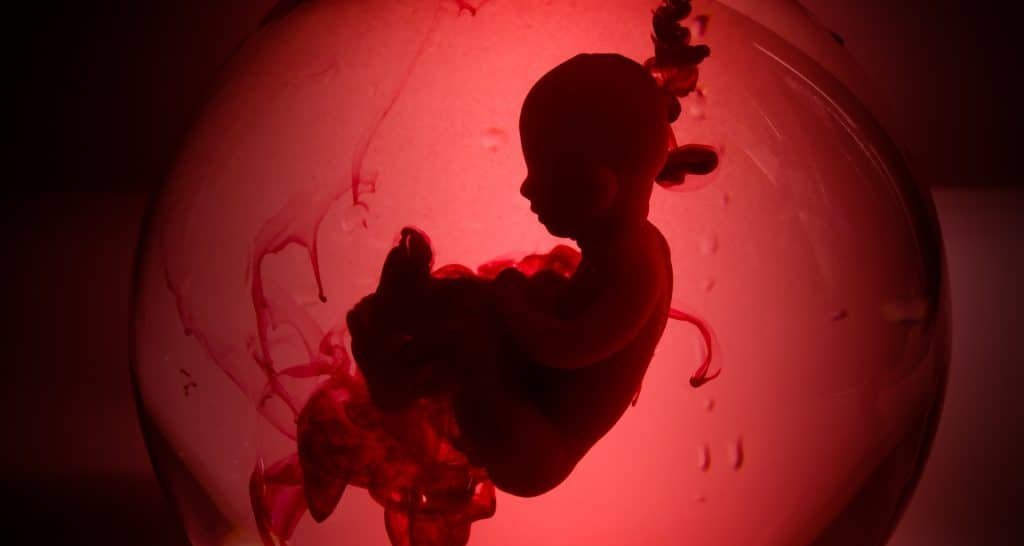 Médicos realizam cirurgia cardíaca em feto de 29 semanas dentro do útero em Porto Alegre - Imagem do artigo original