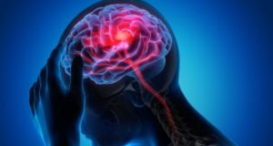 Especialistas detalham principais sequelas do AVC e a importância da reabilitação precoce