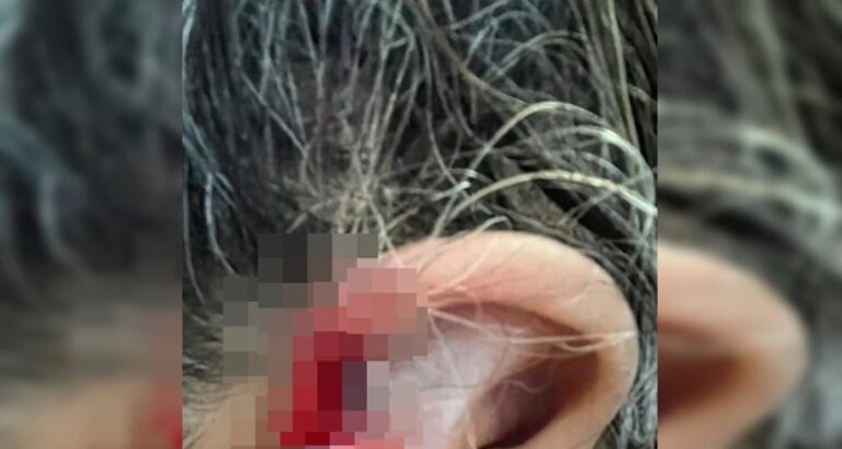 Neto é preso após morder e engolir parte da orelha da avó em Anápolis